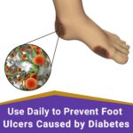 SkinSmart Daily Foot Cleanser for At-Risk Feet, Removes Bacteria to Help Avoid Infections, 8 ounce Spray - Image 6