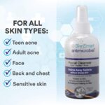 SkinSmart Facial Cleanser for Acne, Targets Bacteria for Active Teenage Athletes Post Workout and Adult Acne, 8 oz Spray Bottle, Safe for Multiple Daily Uses - Image 3