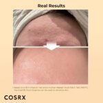 COSRX Snail Mucin 96% Power Repairing Essence 3.38 fl.oz 100ml, Hydrating Serum for Face with Snail Secretion Filtrate for Dull Skin & Fine Lines, Korean Skin Care - Image 2