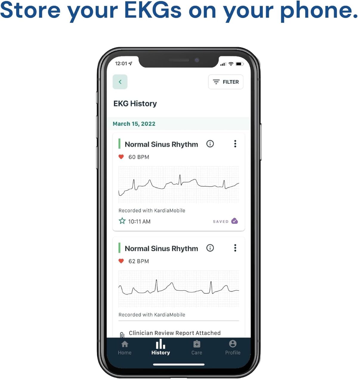 KardiaMobile 1-Lead Personal EKG Monitor – Record at Home – Detects AFib & Irregular Arrhythmias – Easy Results in 30 Seconds – Works w/Most Smartphones - FSA/HSA Eligible - Image 8