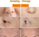 Yeamon 2 in 1 Face Massager Golden Facial Electric 3D Roller and T Shape Arm Eye Nose Massager Skin Care Tool - Image 6