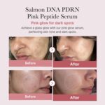 medicube Salmon DNA PDRN Pink Peptide Serum, Pink glow serum, Peptide, Niacinamide, Hydrating & Moisturizing & Firming, Uneven Skin Tone, Korean Skincare | 1.01 fl.oz. (1.01 fl.oz., Salmon DNA PDRN) - Image 2